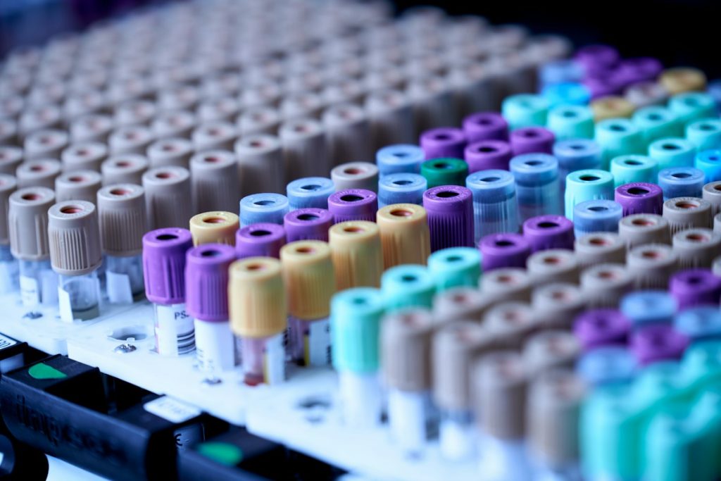 Provette per prelievi del sangue in laboratorio