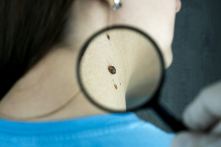 Esame dermatologico con lente di ingrandimento